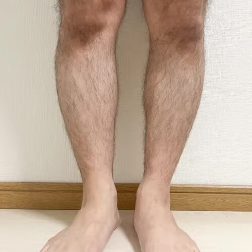 脱毛前：すねに濃い毛が生えている状態（店長・個人の記録）